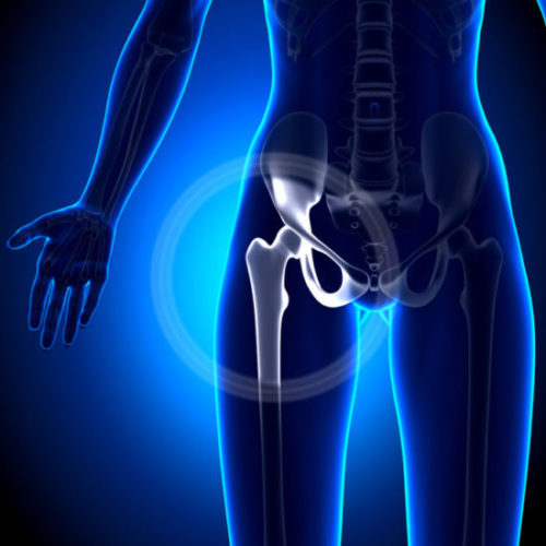 Hip Injuries Can Lead to Pelvic Floor Dysfunction