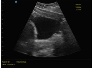 Real Time Ultrasound in Physical Therapy - Body Harmony Physical Therapy