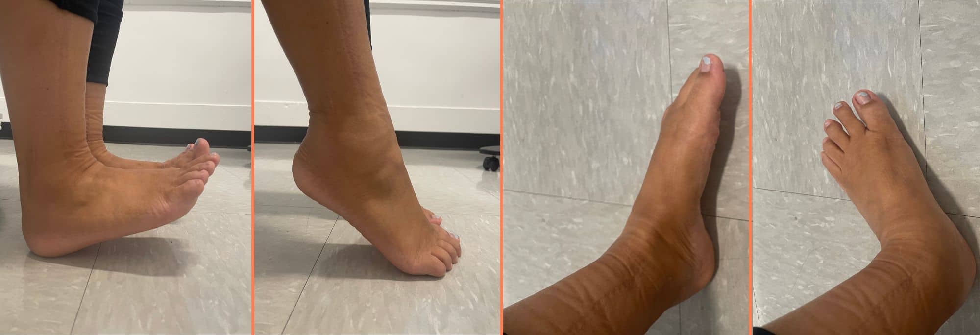 How Can Physical Therapy Help My Ankle? - Body Harmony Physical